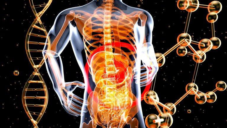 Exercises to Avoid with Sciatica: Tips for Managing Pain
